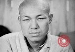 Image of microscopic view of skin Hiroshima Japan, 1945, second 37 stock footage video 65675052709