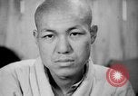 Image of microscopic view of skin Hiroshima Japan, 1945, second 38 stock footage video 65675052709