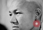 Image of microscopic view of skin Hiroshima Japan, 1945, second 39 stock footage video 65675052709