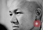 Image of microscopic view of skin Hiroshima Japan, 1945, second 40 stock footage video 65675052709