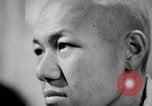 Image of microscopic view of skin Hiroshima Japan, 1945, second 41 stock footage video 65675052709