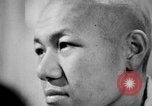 Image of microscopic view of skin Hiroshima Japan, 1945, second 43 stock footage video 65675052709