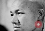 Image of microscopic view of skin Hiroshima Japan, 1945, second 45 stock footage video 65675052709
