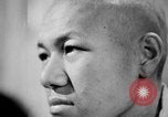 Image of microscopic view of skin Hiroshima Japan, 1945, second 46 stock footage video 65675052709