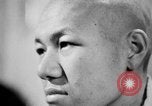 Image of microscopic view of skin Hiroshima Japan, 1945, second 47 stock footage video 65675052709