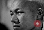 Image of microscopic view of skin Hiroshima Japan, 1945, second 48 stock footage video 65675052709