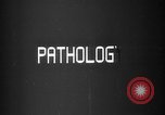 Image of microscopic view of skin Hiroshima Japan, 1945, second 50 stock footage video 65675052709