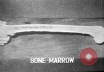 Image of microscopic view of skin Hiroshima Japan, 1945, second 57 stock footage video 65675052709