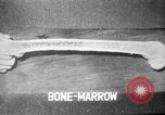 Image of microscopic view of skin Hiroshima Japan, 1945, second 58 stock footage video 65675052709