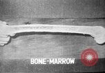 Image of microscopic view of skin Hiroshima Japan, 1945, second 59 stock footage video 65675052709