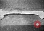 Image of microscopic view of skin Hiroshima Japan, 1945, second 60 stock footage video 65675052709