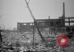 Image of Japanese patients Hiroshima Japan, 1945, second 20 stock footage video 65675052713