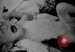 Image of Japanese patients Hiroshima Japan, 1945, second 62 stock footage video 65675052713