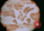 Image of Sexually transmitted disease education United States USA, 1944, second 60 stock footage video 65675053687