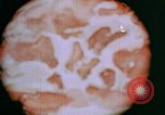 Image of Sexually transmitted disease education United States USA, 1944, second 61 stock footage video 65675053687