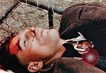 Standbild Opfer im Konzentrationslager Buchenwald Ettersberg Deutschland, 1945, aus Sekunde 46 historischem Filmmaterial Videoclip 65675055278