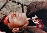 Standbild Opfer im Konzentrationslager Buchenwald Ettersberg Deutschland, 1945, aus Sekunde 47 historischem Filmmaterial Videoclip 65675055278
