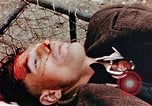 Standbild Opfer im Konzentrationslager Buchenwald Ettersberg Deutschland, 1945, aus Sekunde 51 historischem Filmmaterial Videoclip 65675055278