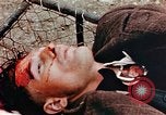 Standbild Opfer im Konzentrationslager Buchenwald Ettersberg Deutschland, 1945, aus Sekunde 52 historischem Filmmaterial Videoclip 65675055278