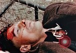 Standbild Opfer im Konzentrationslager Buchenwald Ettersberg Deutschland, 1945, aus Sekunde 53 historischem Filmmaterial Videoclip 65675055278