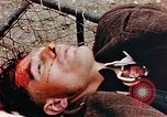 Standbild Opfer im Konzentrationslager Buchenwald Ettersberg Deutschland, 1945, aus Sekunde 54 historischem Filmmaterial Videoclip 65675055278