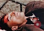 Standbild Opfer im Konzentrationslager Buchenwald Ettersberg Deutschland, 1945, aus Sekunde 55 historischem Filmmaterial Videoclip 65675055278