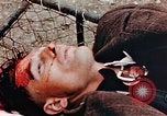 Standbild Opfer im Konzentrationslager Buchenwald Ettersberg Deutschland, 1945, aus Sekunde 56 historischem Filmmaterial Videoclip 65675055278