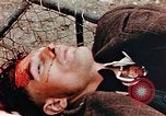 Standbild Opfer im Konzentrationslager Buchenwald Ettersberg Deutschland, 1945, aus Sekunde 58 historischem Filmmaterial Videoclip 65675055278