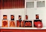 Image of Buchenwald Concentration Camp cutaway body specimens Ettersberg Germany, 1945, second 11 stock footage video 65675055285