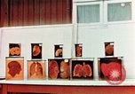 Image of Buchenwald Concentration Camp cutaway body specimens Ettersberg Germany, 1945, second 19 stock footage video 65675055285
