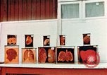 Image of Buchenwald Concentration Camp cutaway body specimens Ettersberg Germany, 1945, second 20 stock footage video 65675055285
