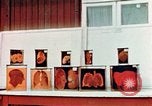 Image of Buchenwald Concentration Camp cutaway body specimens Ettersberg Germany, 1945, second 24 stock footage video 65675055285