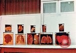 Image of Buchenwald Concentration Camp cutaway body specimens Ettersberg Germany, 1945, second 25 stock footage video 65675055285