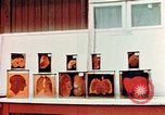 Image of Buchenwald Concentration Camp cutaway body specimens Ettersberg Germany, 1945, second 26 stock footage video 65675055285