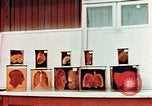 Image of Buchenwald Concentration Camp cutaway body specimens Ettersberg Germany, 1945, second 28 stock footage video 65675055285