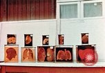 Image of Buchenwald Concentration Camp cutaway body specimens Ettersberg Germany, 1945, second 29 stock footage video 65675055285