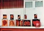 Image of Buchenwald Concentration Camp cutaway body specimens Ettersberg Germany, 1945, second 30 stock footage video 65675055285