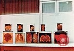 Image of Buchenwald Concentration Camp cutaway body specimens Ettersberg Germany, 1945, second 31 stock footage video 65675055285