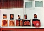 Image of Buchenwald Concentration Camp cutaway body specimens Ettersberg Germany, 1945, second 33 stock footage video 65675055285