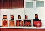 Image of Buchenwald Concentration Camp cutaway body specimens Ettersberg Germany, 1945, second 34 stock footage video 65675055285