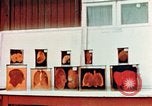 Image of Buchenwald Concentration Camp cutaway body specimens Ettersberg Germany, 1945, second 36 stock footage video 65675055285