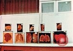 Image of Buchenwald Concentration Camp cutaway body specimens Ettersberg Germany, 1945, second 38 stock footage video 65675055285