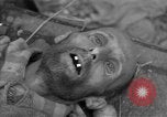 Immagine di Morti e malati prigionieri politici Baviera Germania, 1945, secondo 44 filmato di repertorio 65675055299