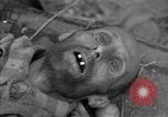 Immagine di Morti e malati prigionieri politici Baviera Germania, 1945, secondo 50 filmato di repertorio 65675055299