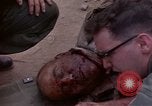 Immagine di Gli americani feriti nell'offensiva del Tet a Saigon Il Vietnam, 1968, secondo 29 filmato di repertorio 65675055534