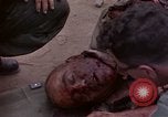 Immagine di Gli americani feriti nell'offensiva del Tet a Saigon Il Vietnam, 1968, secondo 30 filmato di repertorio 65675055534