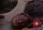 Immagine di Gli americani feriti nell'offensiva del Tet a Saigon Il Vietnam, 1968, secondo 31 filmato di repertorio 65675055534