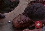 Immagine di Gli americani feriti nell'offensiva del Tet a Saigon Il Vietnam, 1968, secondo 33 filmato di repertorio 65675055534