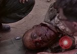 Immagine di Gli americani feriti nell'offensiva del Tet a Saigon Il Vietnam, 1968, secondo 34 filmato di repertorio 65675055534