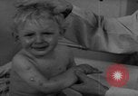 Standbild Kinder mit Haut Infektionen Deutschland, 1946, aus Sekunde 8 historischem Filmmaterial Videoclip 65675056080